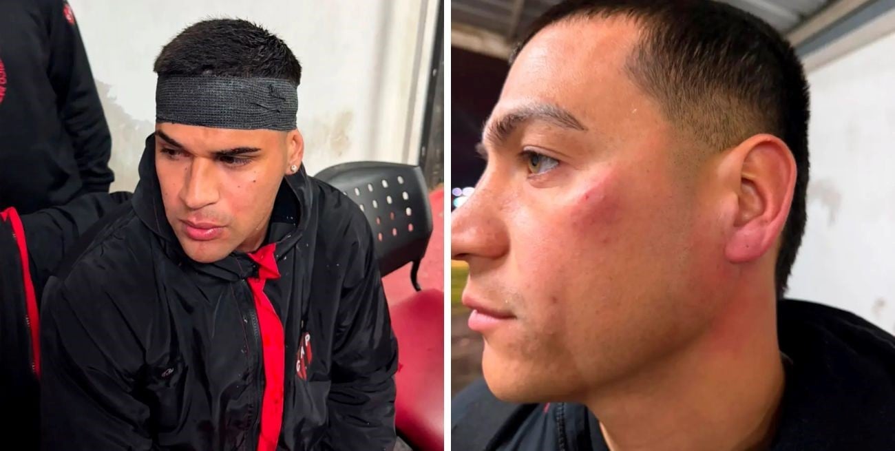 Investigan una agresión a jugadores de Patronato tras la derrota ante Colón