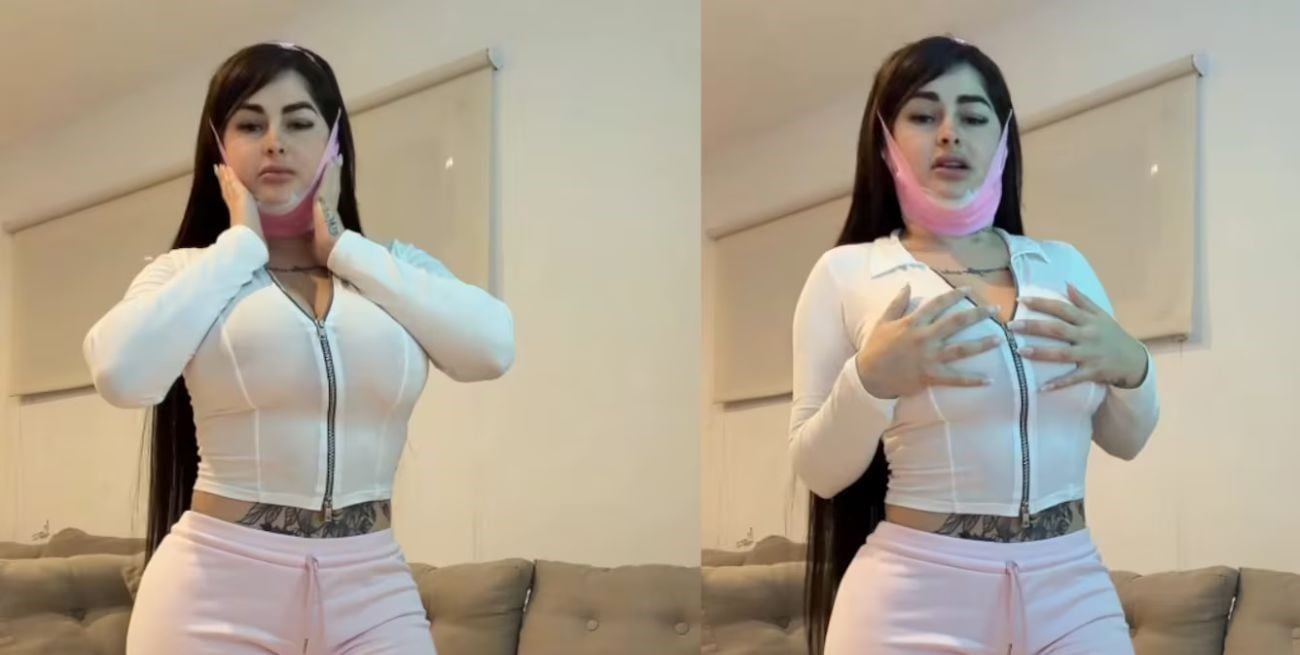 Kami Franco mostró el antes y después de su nueva cirugía estética