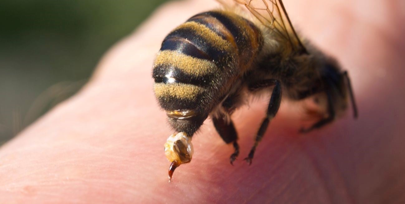 ¿Qué hacer si te pica una abeja o una avispa? Los pasos que pueden aliviar el dolor y cuándo preocuparse
