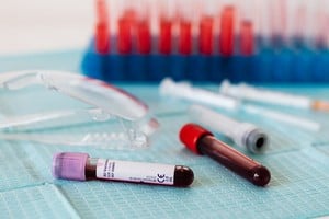 La propuesta se encuentra todavía en etapa de investigación